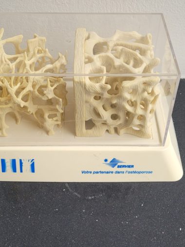 Botplastiek medisch