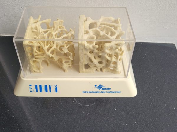 Botplastiek medisch - Afbeelding 4