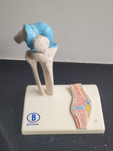 Plastiek kniegewricht