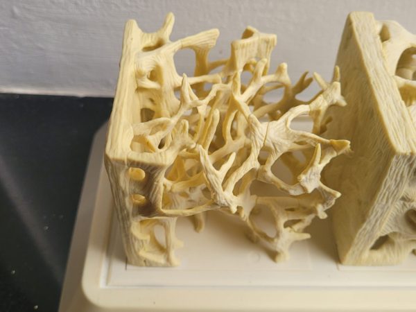 Botplastiek medisch - Afbeelding 3