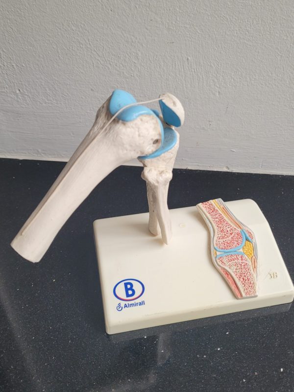 Plastiek kniegewricht - Afbeelding 4