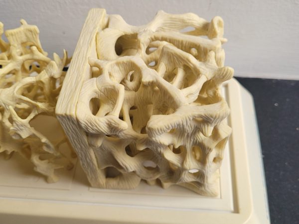 Botplastiek medisch - Afbeelding 5