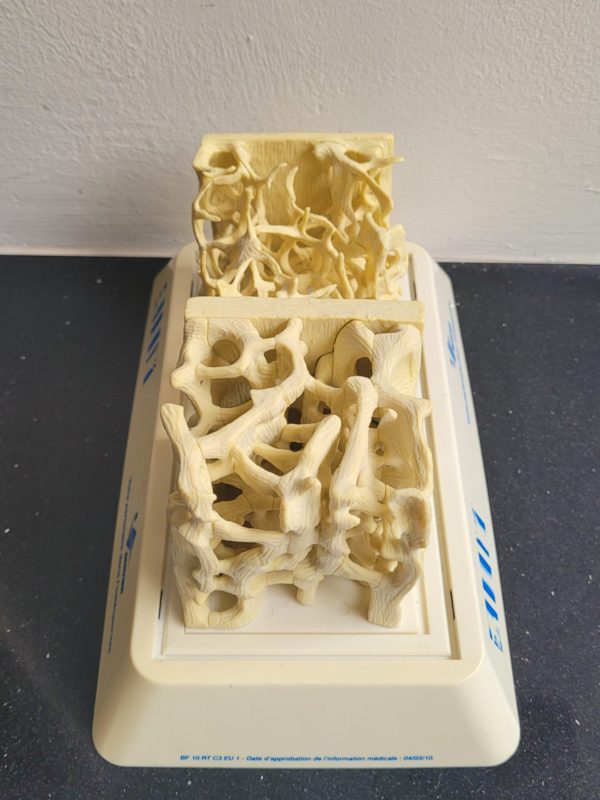 Botplastiek medisch - Afbeelding 2
