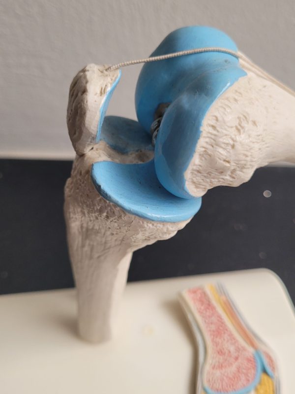 Plastiek kniegewricht - Afbeelding 2