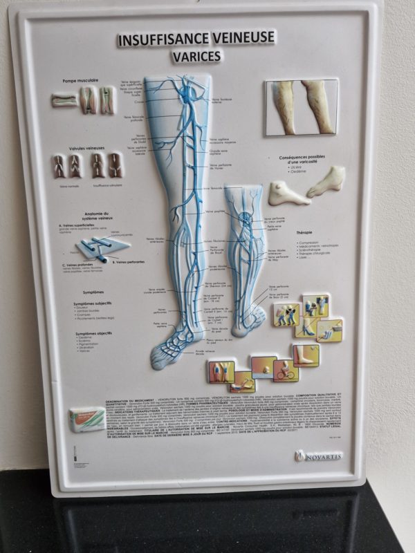 Medische plaat Varices ( spataderen)