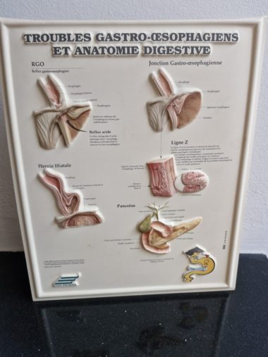Medische plaat gastro enterale problemen