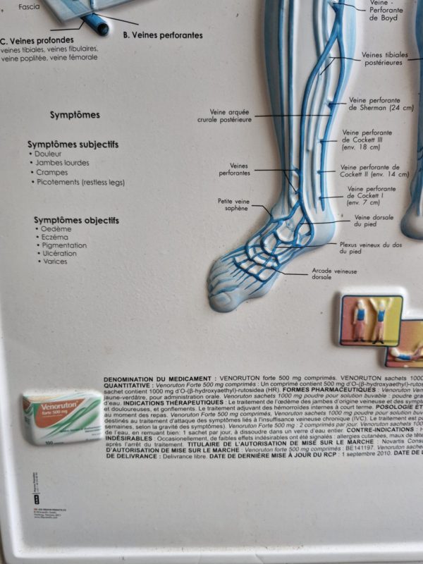Medische plaat Varices ( spataderen) - Afbeelding 4
